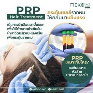 บริการรับแก้ปัญหาผมร่วง - Lover Clinic
