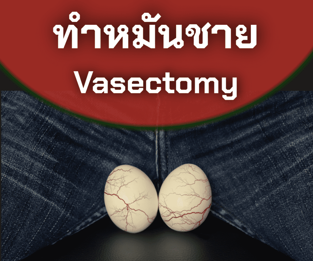 คลินิกสุขภาพชาย - Lover Clinic