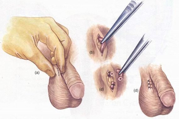 หยุดกังวลเรื่องการรักษาต่อมลูกหมากโต! พบคลินิกและแพทย์เฉพาะทางที่เหมาะสม