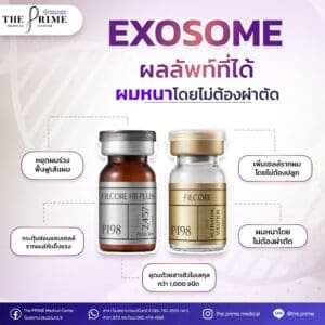 บริการรับแก้ปัญหาผมร่วง - Lover Clinic