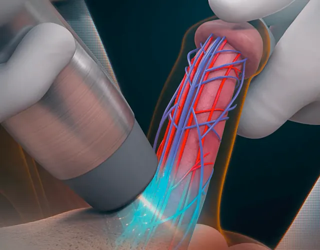 นกเขาไม่ขัน! เมื่อน้องชายไม่แข็ง สัญญาณเตือนภัยและวิธีรับมือภาวะเสื่อมสมรรถภาพทางเพศ