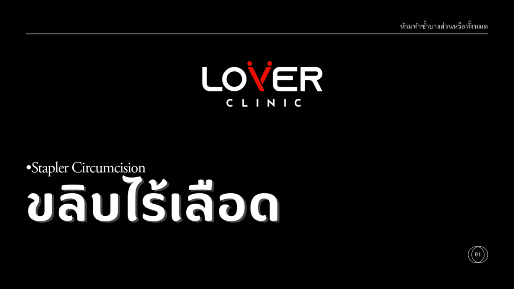 รีวิวขลิบไร้เลือด เคสรีวิวราคาไม่แพง ที่ Lover Clinic โคราช คลินิกสุขภาพเพศชายครบวงจร