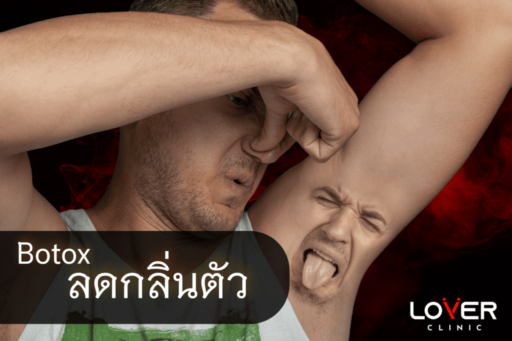 กลิ่นตัวผู้ชาย แก้ได้ด้วยโบท็อกซ์! บอกลาเหงื่อใต้วงแขน เพิ่มความมั่นใจ บทความนี้มีคำตอบ พร้อมเผยวิธีดูแลตัวเองหลังรักษา