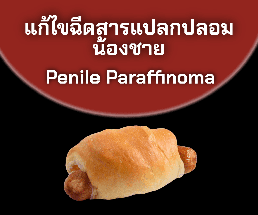 คลินิกสุขภาพชาย - Lover Clinic