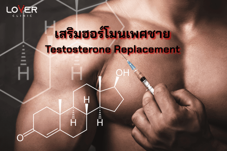 Testosterone Replacement