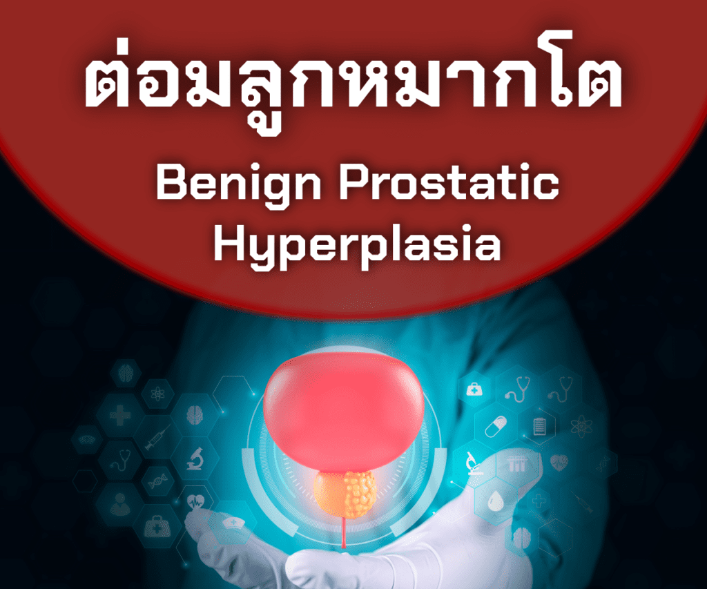 คลินิกสุขภาพชาย - Lover Clinic