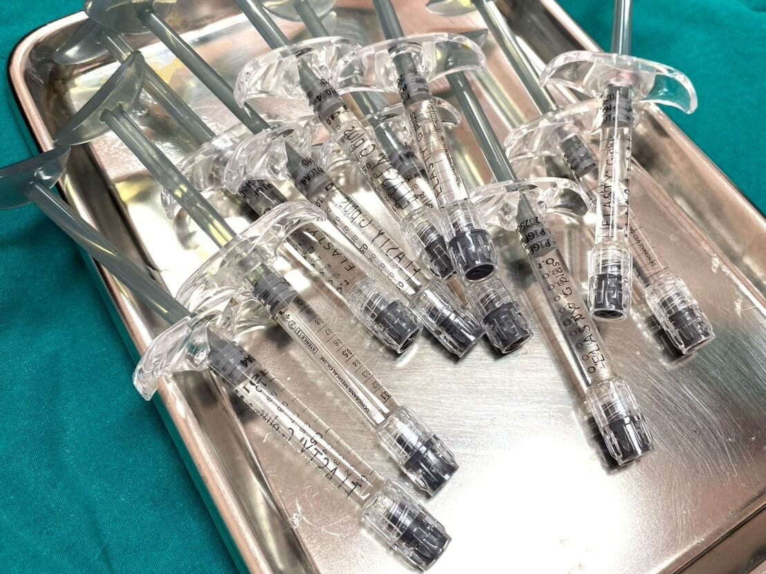 ฟิลเลอร์เพิ่มขนาดน้องชาย